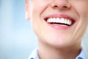 teeth whitening aftercare in Asheville North Carolina
